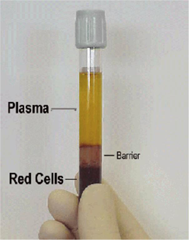 DUI Blood Testing Plasma