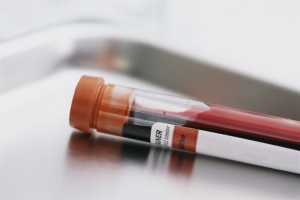 The PA DUI Attorneys at The McShane Firm are experienced in DUI blood testing.