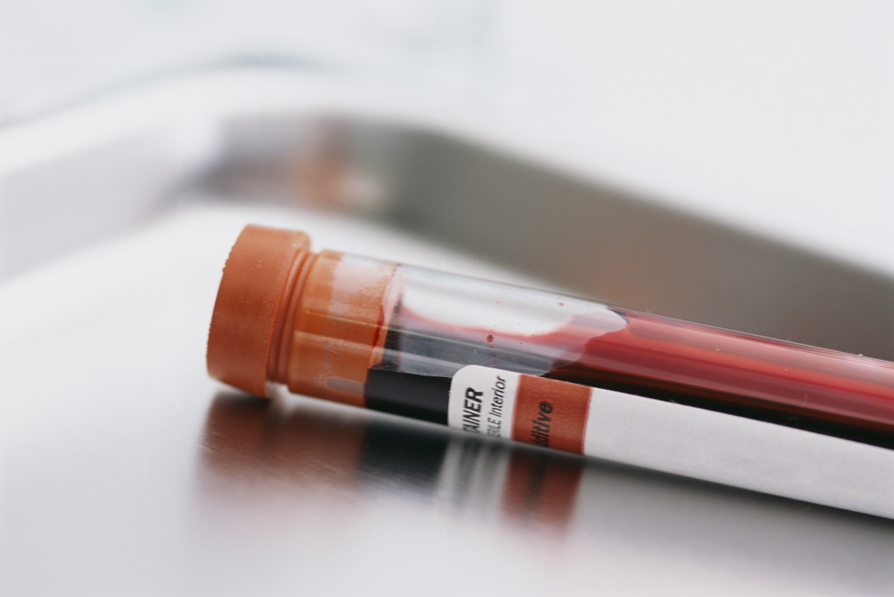 The PA DUI Attorneys at The McShane Firm are experts in DUI blood testing.